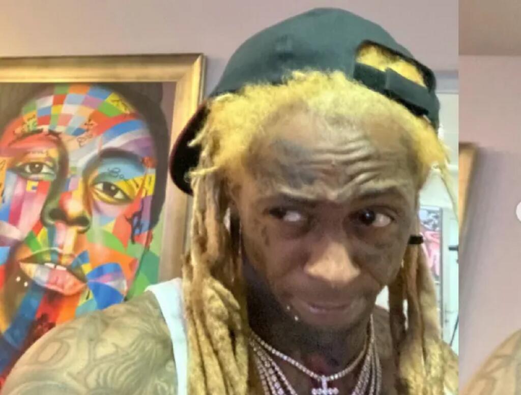 Fans Worry About Lil Wayne’s Health & Old Opioid Addiction After New