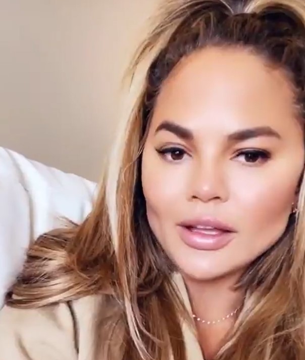 Chrissy Teigen Cheeks