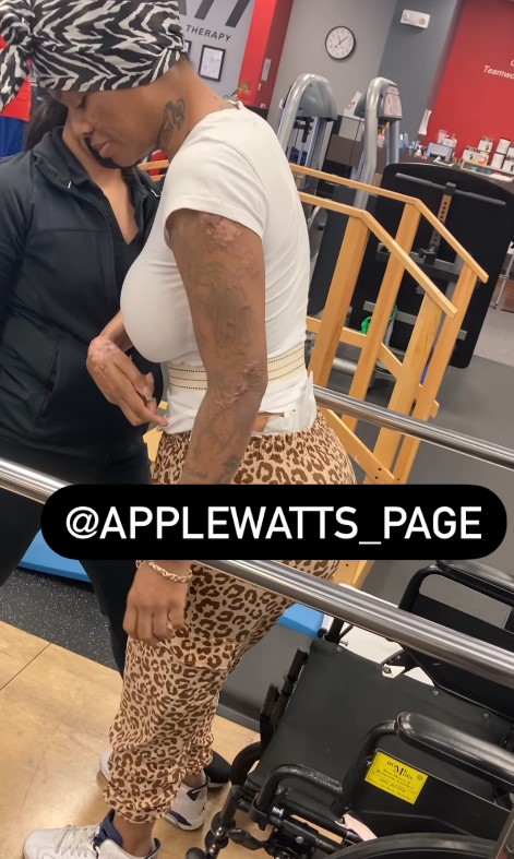 Apple Watts Accident